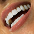 Эффективное лечение зубов в частной клинике